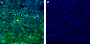 Anti-CCC9 (SLC12A8) (extracellular) Antibody