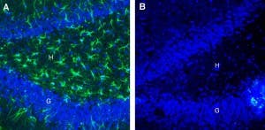 Anti-CLEC7A/Dectin-1 (extracellular) Antibody