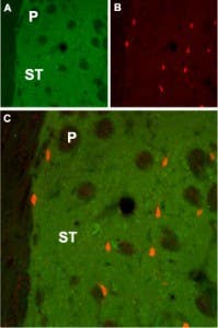 Anti-CHRM1 Antibody