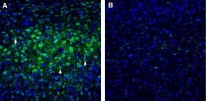 Anti-CHRM3 Antibody