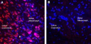 Guinea Pig Anti-CHRM3 Antibody
