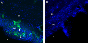 Anti-CHRM3 (extracellular) Antibody