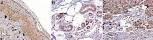 Anti-MC1 Receptor Antibody