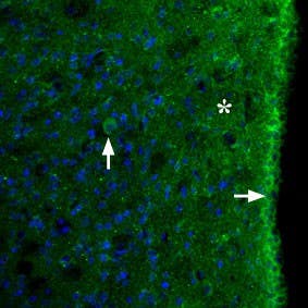 Anti-MC3 Receptor (extracellular) Antibody