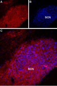 Anti-Melatonin Receptor 1A (MTNR1A) Antibody