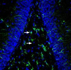 Anti-MRGPRE Antibody