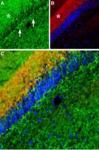 Anti-Noradrenaline Transporter (NET) (extracellular) Antibody