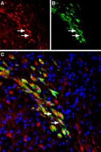 Anti-VMAT2 Antibody