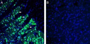Anti-SLC18B1 (VPAT) Antibody