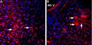 Anti-MCT2 Antibody