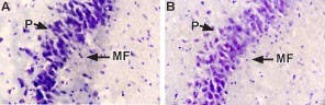 Anti-NGF Antibody