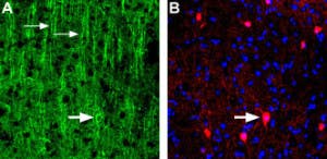 Anti-Nicotinic Acetylcholine Receptor α3 (CHRNA3) (extracellular) Antibody