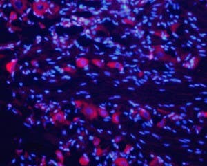 Anti-Nicotinic Acetylcholine Receptor α7 (CHRNA7) (extracellular) Antibody