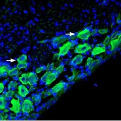 Anti-Nicotinic Acetylcholine Receptor α9 (CHRNA9) Antibody