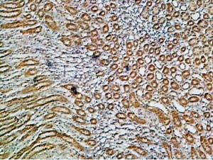Anti-Alpha 1 Na<sup>+</sup>/K<sup>+</sup> ATPase Antibody