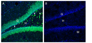 Anti-ATP1B3 (extracellular) Antibody
