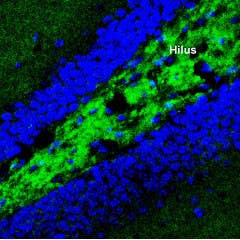 Anti-Synaptotagmin-1 (SYT1) Antibody
