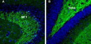 Anti-Synapsin III (SYN3) Antibody