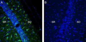 Anti-TREM2 (extracellular) Antibody