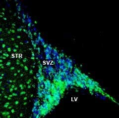 Anti-NPY1R (extracellular) Antibody