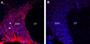 Anti-Neuropeptide S Receptor (extracellular) Antibody