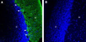 Anti-DSCAM (extracellular) Antibody