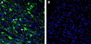 Anti-L1CAM (extracellular) Antibody