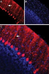 Anti-Nectin-1/PVRL1 (extracellular) Antibody