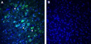 Anti-NEGR1 (extracellular) Antibody