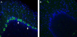 Anti-NMUR1 (extracellular) Antibody