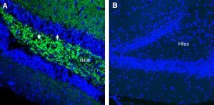 Anti-SV2A Antibody