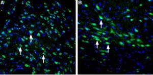 Anti-LRRK2 Antibody
