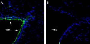 Anti-Parkin Antibody