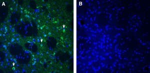 Anti-SLC25A18 (GC2) Antibody