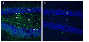 Anti-Netrin-1 Antibody