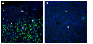Anti-SORL1 (extracellular) Antibody
