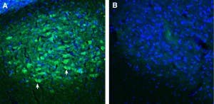 Anti-SORCS2 (extracellular) Antibody