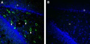 Anti-SARM1 Antibody