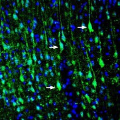 Anti-LRRTM1 (extracellular) Antibody