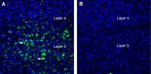 Anti-LRRTM2 (extracellular) Antibody