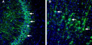 Anti-ASTN1 (extracellular) Antibody