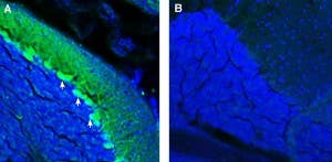 Anti-ADAM23 (extracellular) Antibody
