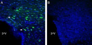 Anti-NGL-2/LRRC4 (extracellular) Antibody