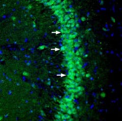 Anti-NGL-3/LRRC4B (extracellular) Antibody