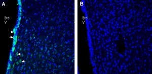 Anti-Progranulin Antibody