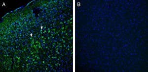 Anti-Robo1 (extracellular) Antibody