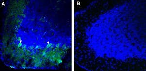 Anti-Robo3 (extracellular) Antibody