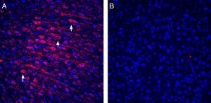Anti-Tetraspanin-3 (extracellular) Antibody