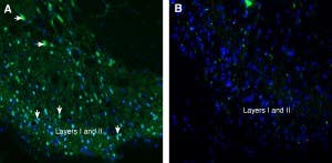 Anti-Tetraspanin 2 (extracellular) Antibody