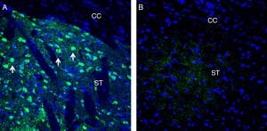 Anti-Neuronal Pentraxin 1 (NPTX1) Antibody